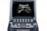 Sonosite M-Turbo